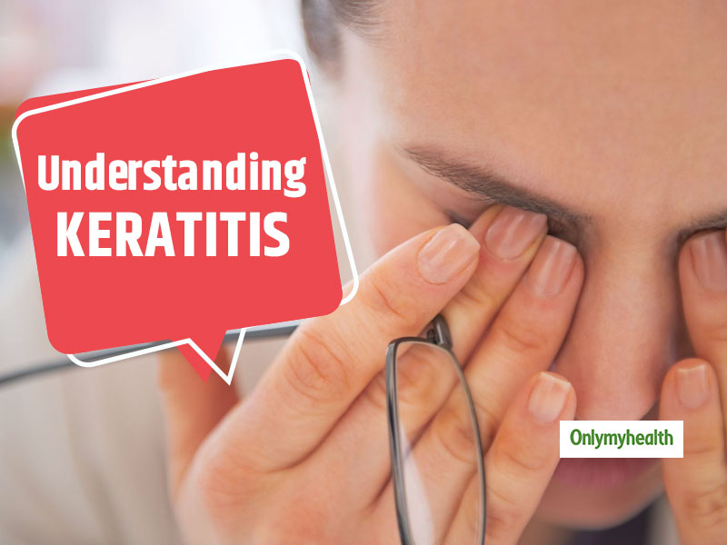 What is the expected duration of Keratitis?